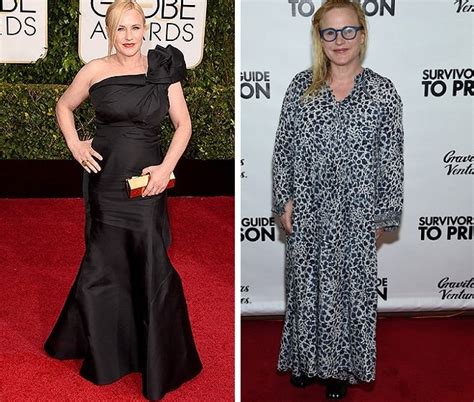 patricia arquette boobs|Patricia Arquette, Before and After